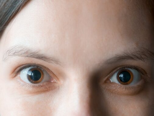 Les effets oculaires de la consommation de substances - Comment les drogues affectent vos yeux