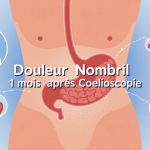 Illustration douleur nombril 1 mois après coelioscopie informative